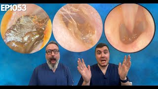 SO MANY EAR WAX REMOVALS  EP1053 [upl. by Elleinnod]