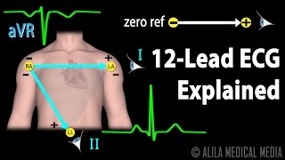 12 Lead ECG Explained Animation [upl. by Nydia]