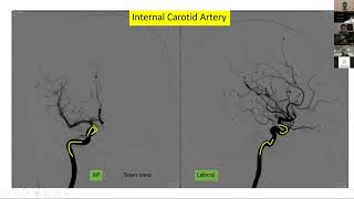 Neurovascular Anatomy [upl. by Rettke]