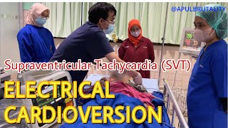 Emergency synchronized cardioversion in supraventricular tachycardia SVT  AVNRT [upl. by Dirtsa]