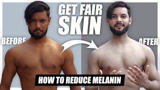 How to Reduce Melanin In Body😍  Get Fair Skin👨🏻 [upl. by Eggett11]