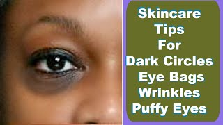 Get Rid of Dark Circles FAST with These Shocking Skincare Tips [upl. by Acinorahs]