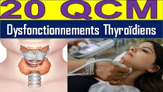 20 QCM Hyperthyroïdie ou Hypothyroïdie  Découvrez les Causes et Solutions [upl. by Heins]