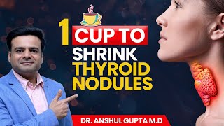 1 Cup Remedy to Shrink Thyroid Nodules [upl. by Vaientina348]