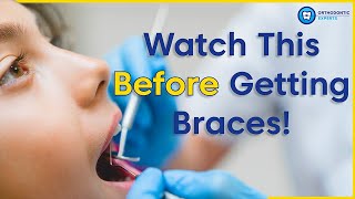 What To Know Before Getting Braces  8 Tips To Prepare You For Braces [upl. by Felicie235]