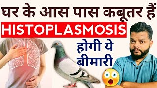 Histoplasmosis Causes Symptoms amp Treatment In Hindi  Histoplasma Capsulatum [upl. by Pascha]