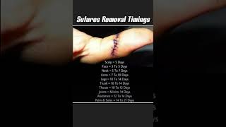 Sutures removal timings [upl. by Sined]