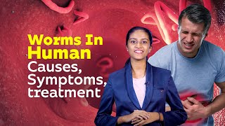 Worms In Human  Causes Symptoms treatment  Healthy Life Style  Worm Diseases [upl. by Lela]