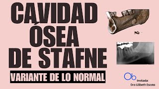 Variante de lo normal CAVIDAD OSEA DE STAFNE [upl. by Korb720]