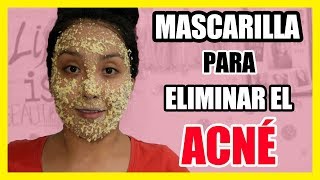 MASCARILLA de AVENA para ELIMINAR el ACNÉ  Mascarillas Naturales  Nadia Elias [upl. by Notgnimer]