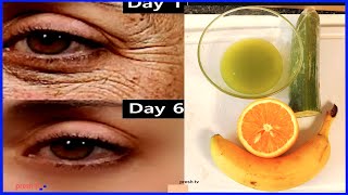 80 year old remove wrinkles under eyes using Cucumber remedy for 3 days  eye wrinkles home remedy [upl. by Naibaf]