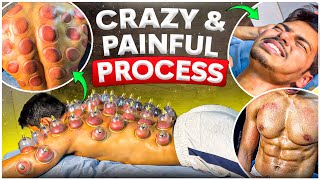 CUPPING THERAPY 😳😩  Lean Bulk Ep 01 [upl. by Baniez]