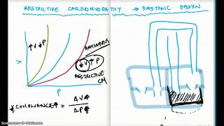 Restrictive Cardiomyopathy and Diastolic Dysfunction [upl. by Alix648]