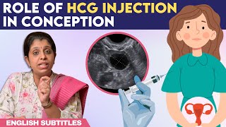 Role Of hCG Injection In Conception  hCG ஊசி செலுத்திய பிறகு கரு முட்டை எப்போது வெளிவரும் [upl. by Nrubua953]