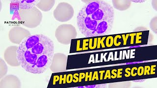 LAP SCORE Leukocyte Alkaline Phosphatase Score  By Dr Aditi Kumar [upl. by Karin149]