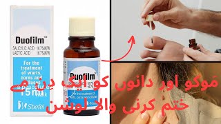 Remove mols and warts and acne remove solution within one Lotion 🧴  Duofilm Lotion [upl. by Cooperstein]