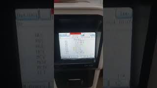 How To Print Your CBC Result in Sysmex Xp 100 sysmex hematologyanalyzer shorts [upl. by Ebbie]