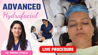 Advanced Hydrafacial Live Procedure  Advantages of Advance Hydrafacial  Clinic Eximus [upl. by Currier]