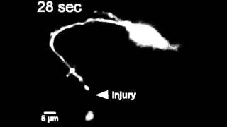 Kinesin1–powered microtubule sliding initiates axonal regeneration in Drosophila cultured neurons [upl. by Decrem]