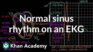 Normal sinus rhythm on an EKG  Circulatory System and Disease  NCLEXRN  Khan Academy [upl. by Tamer]