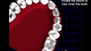 Dental Simulator for Endodontic Access Cavity Preparation [upl. by Tnarud]