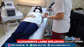 Alexandrite Lazer Epilasyon İşlemi Nedir Nasıl Uygulanmaktadır ❤️lazerepilasyonalexandritelazer [upl. by Isabea15]