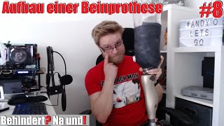 Aufbau einer Unterschenkel Prothese Behindert Na und 8 [upl. by Stricklan]