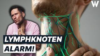 Unbekannte Knubbel Gefährlich von harmlos unterscheiden Wichtigsten Fakten zu großen Lymphknoten [upl. by Clorinda]