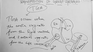 Transposition of great arteries CONGENITAL HEART DISEASEeasy explanation in hindi [upl. by Haleemak]