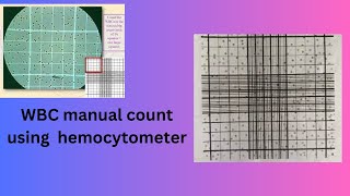 WBC manual count using hemocytometer [upl. by Dowd]