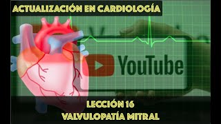 16 VALVULOPATÍA MITRAL [upl. by Allrud]