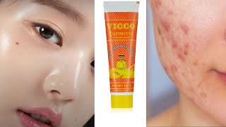 Vicco turmeric cream review ✨ vicco cream  Honest 💯 review  vicco turmeric fayde aur nuksan [upl. by Farlee]