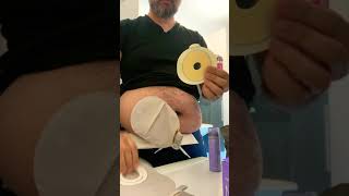 Soins d’une Stomie digestive en 5 minutes ostomy care in less than 5mn [upl. by Rodmann]