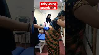 Ankylosing spondylitis treatment 93085113578409313131 drrajneeshkant [upl. by Stephen]