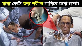 মাথা প্রতিস্থাপন  এক শরীর থেকে মাথা কেনে অন্য শরীরের লাগানো হলো  Head transplant [upl. by Concoff481]