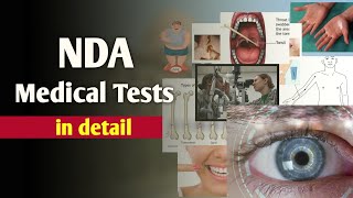 NDA Medical Complete Information  NDA की Medical Tests Detail मे  SSB Medical ndamedical [upl. by Banna]