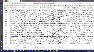 Online EEG viewer webbased  NeuronSpectrumWEB [upl. by Ailak971]