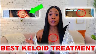 Get Rid of Your Keloids  QUICKEST and SAFEST Solution [upl. by Ysnat]