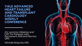 AV Junction Ablation and CRT for Patients with Permanent Afib and Narrow QRS [upl. by Jamil]