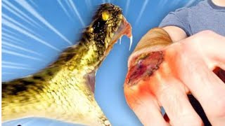 Surviving a Rattlesnake Bite What You Need to Know [upl. by Osnofledi]