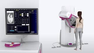 Sinomdt Tomosynthesis 3D Digital Mammography Machine Introduction [upl. by Tawsha758]