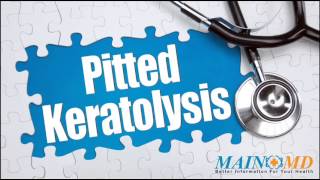 Pitted Keratoylysis ¦ Treatment and Symptoms [upl. by Blumenfeld]