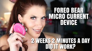 FOREOTHE BEARMICRO CURRENT DEVICE2 Weeks 2 minute FaceliftBeauty over 50 [upl. by Anerrol]