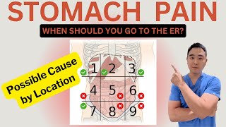 Stomach Pain Explained Causes by Area amp When to Visit the ER [upl. by Noicnecsa830]