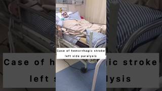 Hemorrhagic stroke left side paralysis physiotheraphy shortsfeed paralysis shortsvideo viral [upl. by Sigismund325]