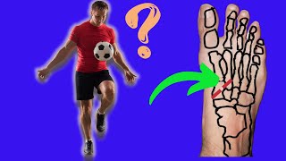 LISFRANC INJURY  When Can I RETURN TO SPORT [upl. by Resa]