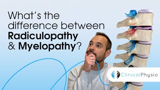 What’s the difference between Radiculopathy and Myelopathy  Expert Physio Guide [upl. by Ilenay]