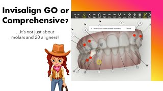 Invisalign ClinCheck Choosing between iGo vs Comprehensive  IPR tips [upl. by Dallis142]