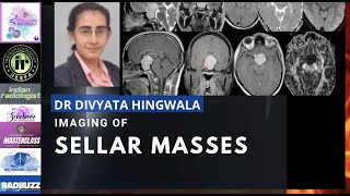 IMAGING OF SELLAR MASSES  DR DIVYATA HINGWALA  MRI TEACHING COURSE  PITUITARY MICROADENOMA [upl. by Karwan273]