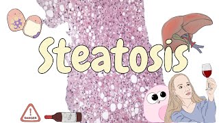 Steatosis  liver pathology [upl. by Ardnekat]